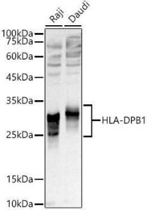 Western blot analysis of extracts of various cell lines, using Anti-MHC Class II beta Antibody (A306106) at 1:1,000 dilution