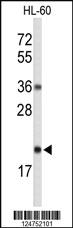 Anti-RNH2C Rabbit Polyclonal Antibody