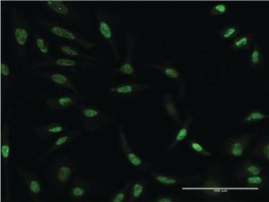 Anti-AKT3 Mouse Monoclonal Antibody [clone: 2F3]