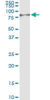 Anti-DMPK Polyclonal Antibody Pair