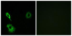 Immunofluorescence analysis of A549 cells using Anti-GRM7 Antibody. The right hand panel represents a negative control, where the antibody was pre-incubated with the immunising peptide