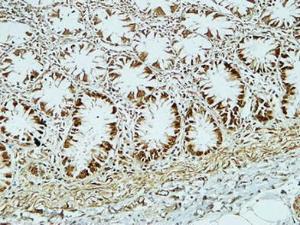 Immunohistochemical analysis of paraffin-embedded human colon using Anti-CD34 Antibody