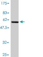 Anti-NNMT Mouse Polyclonal Antibody