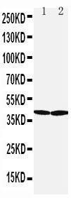 Anti-SLC10A1 Rabbit Polyclonal Antibody