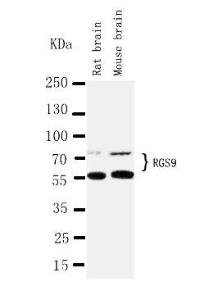 Anti-RGS9 Rabbit Antibody