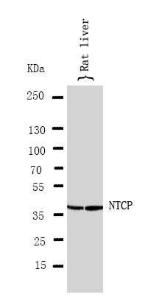 Anti-SLC10A1 Rabbit Polyclonal Antibody