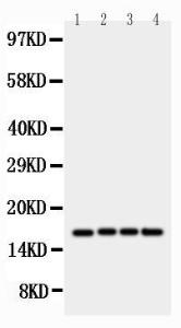 Anti-survivin Rabbit Polyclonal Antibody