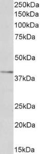 Anti-OLR1 Antibody (A83101) (0.1 µg/ml) staining of Human Liver lysate (35 µg protein in RIPA buffer). Primary incubation was 1 hour. Detected by chemiluminescence