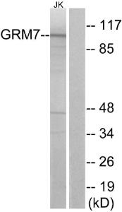 Western blot analysis of lysates from Jurkat cells using Anti-GRM7 Antibody. The right hand lane represents a negative control, where the antibody is blocked by the immunising peptide