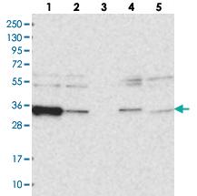 Anti-ACTR6 Rabbit Polyclonal Antibody