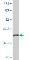 Anti-HDAC8 Mouse Monoclonal Antibody [clone: 2F4]