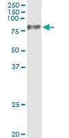 Anti-UMOD Antibody Pair