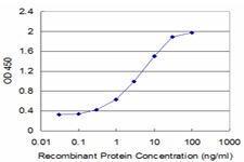 Anti-CBS Mouse Monoclonal Antibody [clone: 6B8]