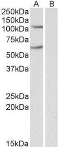 Anti-IREB2 Goat Polyclonal Antibody