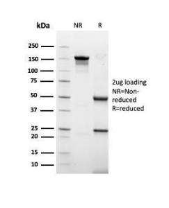 SDS-PAGE analysis of Anti-Keratin 77 Antibody [rKRTL/6616] under non-reduced and reduced conditions; showing intact IgG and intact heavy and light chains, respectively. SDS-PAGE analysis confirms the integrity and purity of the Antibody