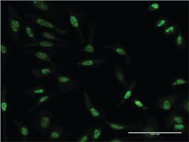 Anti-AKT3 Mouse Monoclonal Antibody [clone: 2F3]