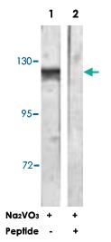 Anti-CBL Rabbit Polyclonal Antibody