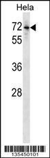 Anti-BMPR1B Rabbit Polyclonal Antibody (AP (Alkaline Phosphatase))