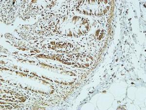 Immunohistochemical analysis of paraffin-embedded human colon using Anti-CD34 Antibody