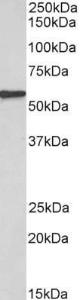 Anti-EPHX2 Antibody (A83102) (0.3 µg/ml) staining of Human Kidney lysate (35 µg protein in RIPA buffer). Primary incubation was 1 hour. Detected by chemiluminescence