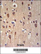 Anti-GRPR Rabbit Polyclonal Antibody (Biotin)