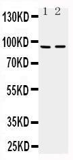 Anti-ADAMTS4 Rabbit Polyclonal Antibody