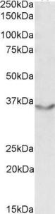 Anti-JAM2 Antibody (A84690) (0.5 µg/ml) staining of Human Heart lysate (35 µg protein in RIPA buffer) with (B) and without (A) blocking with the immunising peptide. Primary incubation was 1 hour. Detected by chemiluminescence