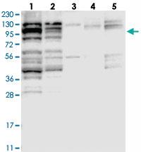 Anti-RNF216 Rabbit Polyclonal Antibody