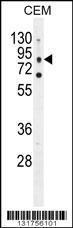 Anti-CLCN7 Rabbit Polyclonal Antibody (FITC (Fluorescein Isothiocyanate))