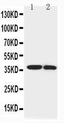 Anti-IGFBP1 Rabbit Polyclonal Antibody