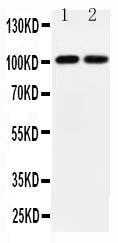 Anti-Glutamate Receptor 3 Rabbit Antibody