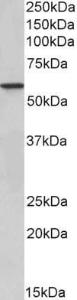 Anti-EPHX2 Antibody (A83103) (0.5 µg/ml) staining of Human Kidney lysate (35 µg protein in RIPA buffer). Primary incubation was 1 hour. Detected by chemiluminescence