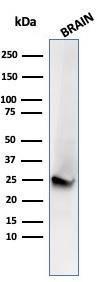 Western blot analysis of human brain tissue lysate using Anti-PGP9.5 Antibody [UCHL1/4556R]