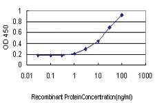 Anti-ACTA2 Mouse Monoclonal Antibody [clone: 4A8-2H3]