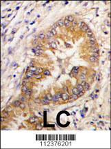 Anti-CDCA8 Rabbit Polyclonal Antibody (FITC (Fluorescein Isothiocyanate))