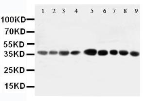 Anti-AIMP2/p38 Rabbit Polyclonal Antibody