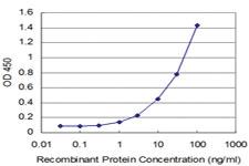 Anti-AKT3 Mouse Monoclonal Antibody [clone: 2F3]