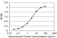 Anti-CBS Mouse Monoclonal Antibody [clone: 5F7]