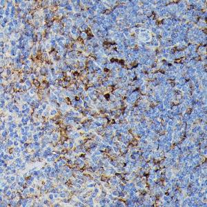 Immunohistochemistry analysis of paraffin-embedded mouse spleen using Anti-MHC Class II beta Antibody (A306106) at a dilution of 1:100 (40X lens). Perform high pressure antigen retrieval with 10 mM citrate buffer pH 6.0 before commencing with IHC staining protocol