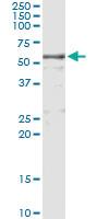 Anti-KNG1 Antibody Pair