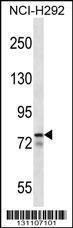 Anti-MLXIPL Rabbit Polyclonal Antibody