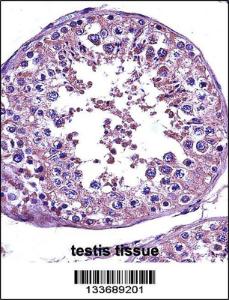 Anti-STAT4 Rabbit Polyclonal Antibody (FITC (Fluorescein Isothiocyanate))