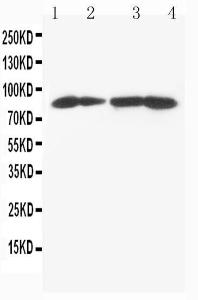 Anti-MTA1 Rabbit Polyclonal Antibody