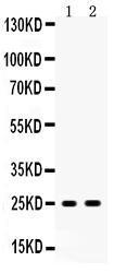 Anti-PSCA Rabbit Polyclonal Antibody