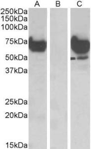 HEK293 lysate (10ug protein in RIPA buffer) overexpressing Human EPM2AIP1 with DYKDDDDK tag probed with Anti-EPM2AIP1 Antibody (A84691) (1 µg/ml) in Lane A and probed with anti-DYKDDDDK Tag (1/1000) in lane C