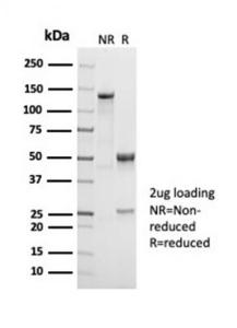 Anti-CD38 Rabbit Recombinant Antibody [clone: CD38/7017R]