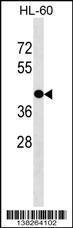 Anti-GPR88 Rabbit Polyclonal Antibody