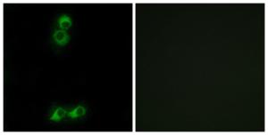 Immunofluorescence analysis of MCF7 cells using Anti-OR10J5 Antibody. The right hand panel represents a negative control, where the antibody was pre-incubated with the immunising peptide