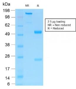 SDS-PAGE analysis of Anti-p75 NGF Receptor Antibody [NGFR/1997R] under non-reduced and reduced conditions; showing intact IgG and intact heavy and light chains, respectively. SDS-PAGE analysis confirms the integrity and purity of the antibody