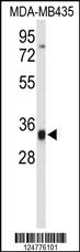 Anti-POLN Rabbit Polyclonal Antibody